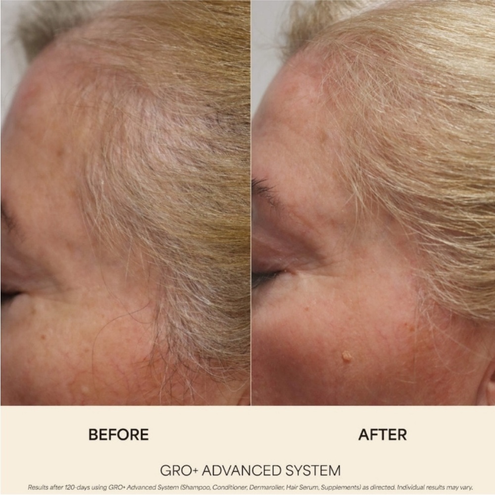 NIB VEGAMOUR GRO ADVANCED HAIR GROWTH SYSTEM - Picture 5 of 10